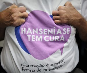 MPAC-Seminário-Hanseníase-Foto.-Odair-Leal-Secom-6